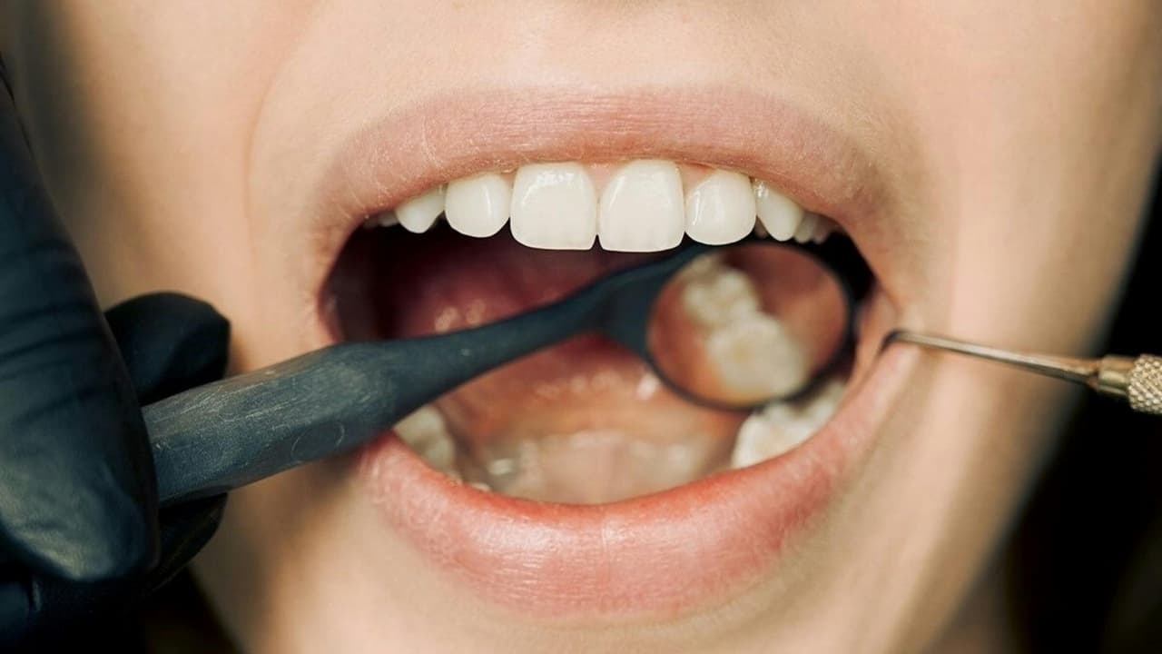 7 oral health signs you should never ignore: Oral cancer isn’t just a smoker’s disease