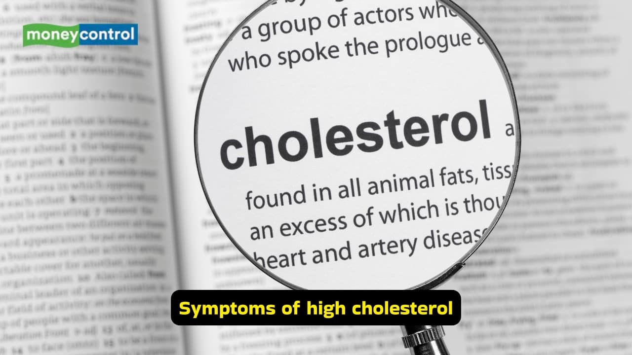 8 symptoms of high cholesterol that show up on your face