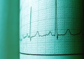 Fatty heart symptoms, causes, and simple, expert-approved tips to keep your heart healthy