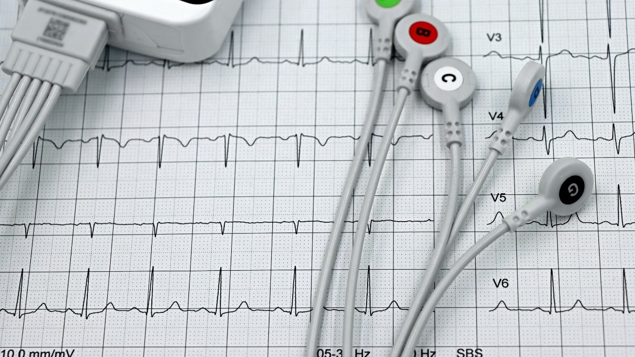 Heart attacks without chest pain: Why atypical symptoms are dangerous