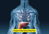 8 proven strategies to reverse fatty liver for Optimal liver health