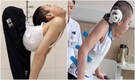 China’s ’folded boy’ stands up straight after doctors fix 180 degree bent spine: ‘Feeling reborn’