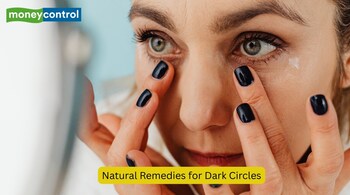 From sleepless nights to genetics, dark circles have many triggers. Here’s how skincare, natural remedies, and simple lifestyle changes can help brighten tired eyes. (Image: Canva)