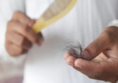 Your soda could be making you bald, here's why