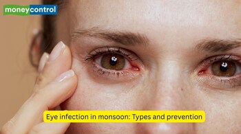 Conjunctivitis and styes are common during the rainy season, but good hygiene and timely medical care can protect your vision. (Image: Canva)