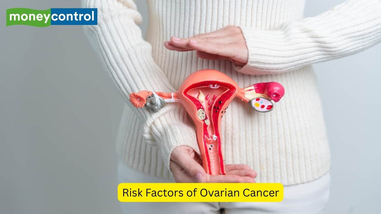 From genetics to lifestyle: Risk factors of ovarian cancer every woman should know