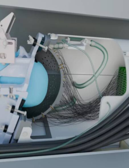 The brain’s new remote control