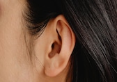 Tinnitus relief at home: 8 simple and natural ways to reduce ringing in the ears