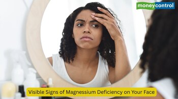 Subtle changes in your skin, eyes, and facial muscles can be early warning signs of magnesium deficiency. (Image: Canva)