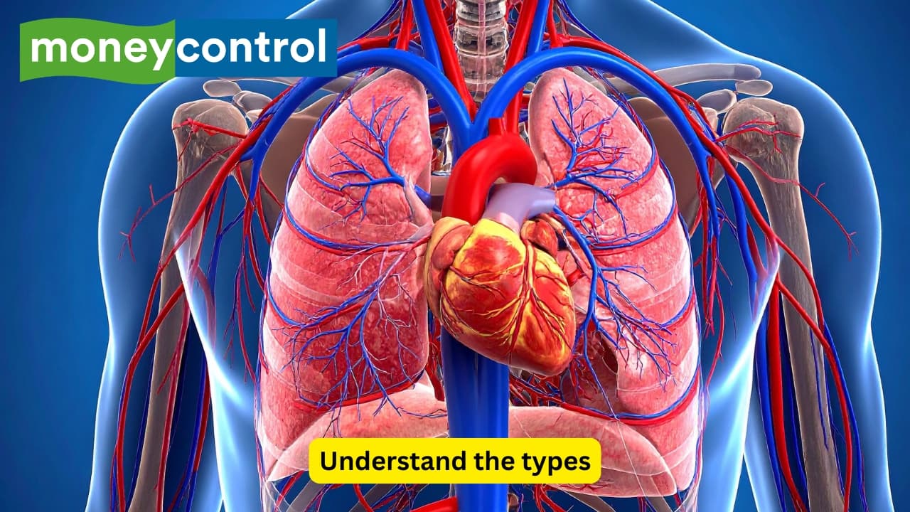 Understand the types There’s more than one kind of heart inflammation. One affects the heart muscle, another affects the outer lining, and one even targets the valves inside, like myocarditis, pericarditis and endocarditis. They all sound scary, but knowing what’s going on helps you and your doctor manage it better.(Image: Canva)