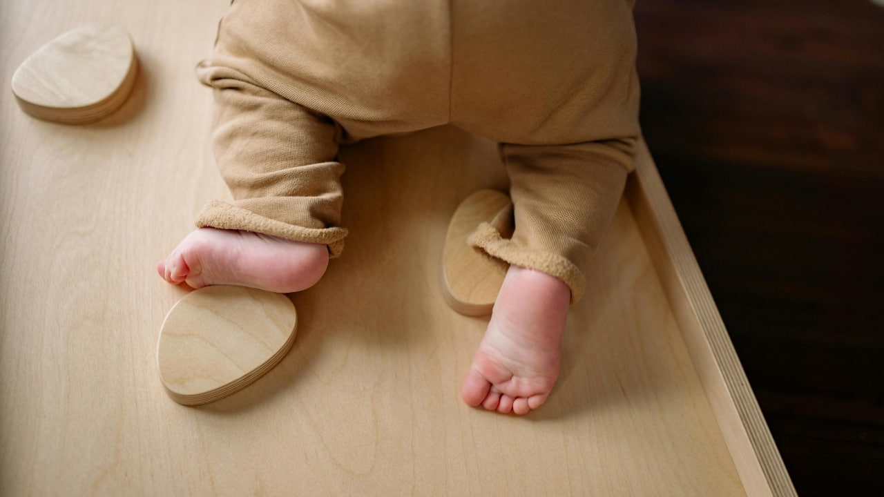 What is hip dysplasia and how does it affect the children?