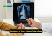 Symptoms of drug-resistant TB: Pulmonologist on why early treatment is critical