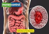 10 things about gastrointestinal bleeding: Its causes, symptoms, investigations and management