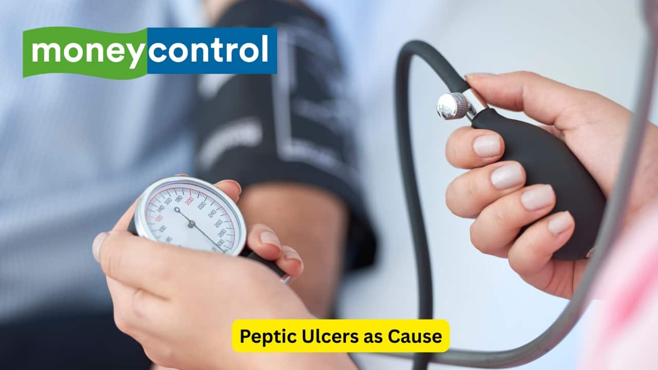 Peptic Ulcers as Cause One of the most common causes of upper gastrointestinal tract is peptic ulcers. Peptic ulcers are sores that may develop on the oesophagus, stomach or small intestine. These are usually caused by a pathogen known as Helicobacter pylori. Long term use of non-steroid anti-inflammatory drugs.(Image: Canva)