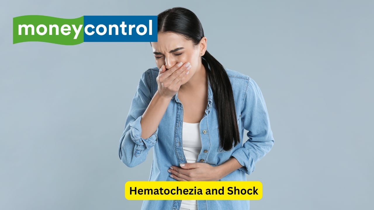 Hematochezia and Shock Severe or massive upper gastrointestinal bleeding can cause maroon or bright-red stools, that is seen as a passage of frank blood in the stools. This is known as hematochezia. Other symptoms may include dizziness, extreme pallor and shock. Anaemic signs may be seen as well.(Image: Canva)   