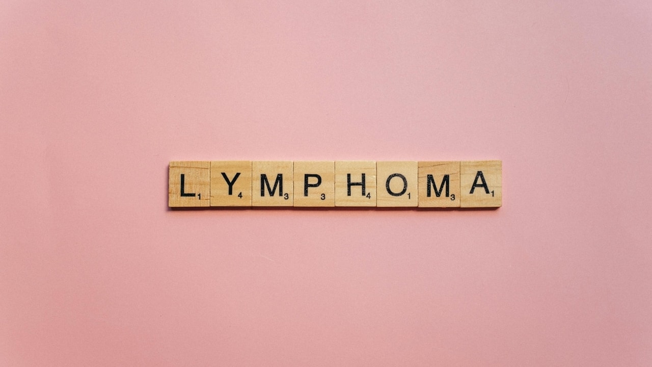 Early symptoms of lymphoma: Identification is tricky because it looks similar to viral infections, warns oncologist