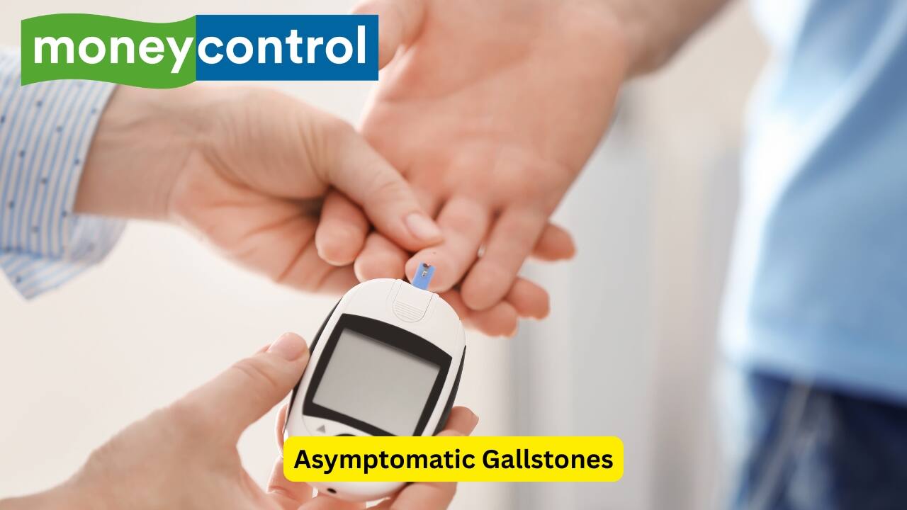 Asymptomatic Gallstones Asymptomatic gallstones are usually made up of cholesterol, and are often single. It may be discovered when an ultrasound is done for other reasons. Such a stone may not require treatment until it is seen in people with diabetes, or those who have low immunity.(Image: Canva)