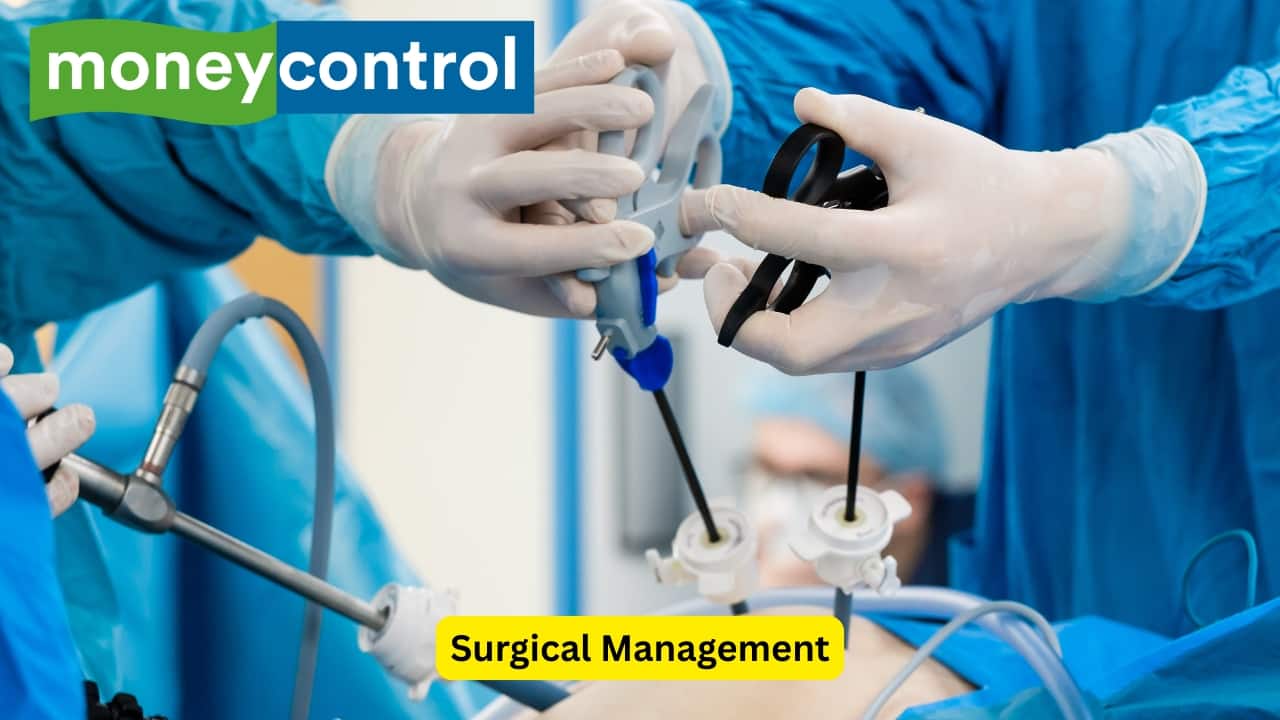Surgical Management Laparoscopic cholecystectomy, a minimally invasive procedure that aids in removing the gall bladder. It uses scopes and involves smaller incisions as opposed to open cholecystectomy. However, gallstones must be differentiated from kidney stones and calcified lymph nodes on the X-rays.(Image: Canva) Disclaimer: This article, including health and fitness advice, only provides generic information. Don’t treat it as a substitute for qualified medical opinion. Always consult a specialist for a specific health diagnosis.  