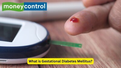 What is gestational diabetes mellitus: 10 things to know about gestational diabetes during pregnancy