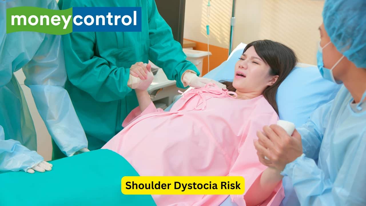 Shoulder Dystocia Risk Gestational diabetes mellitus can result in a disproportionate growth of the baby, with an increase in the shoulder to head ratio. This can predispose to shoulder dystocia, which is an obstetric emergency where the baby’s shoulder gets stuck once the head has emerged.(Image: Canva)