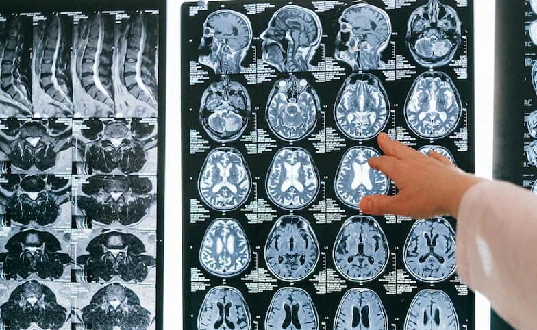 Kerala brain-eating amoeba scare: 21 dead, 80 infected - why stagnant freshwater pose fatal risk