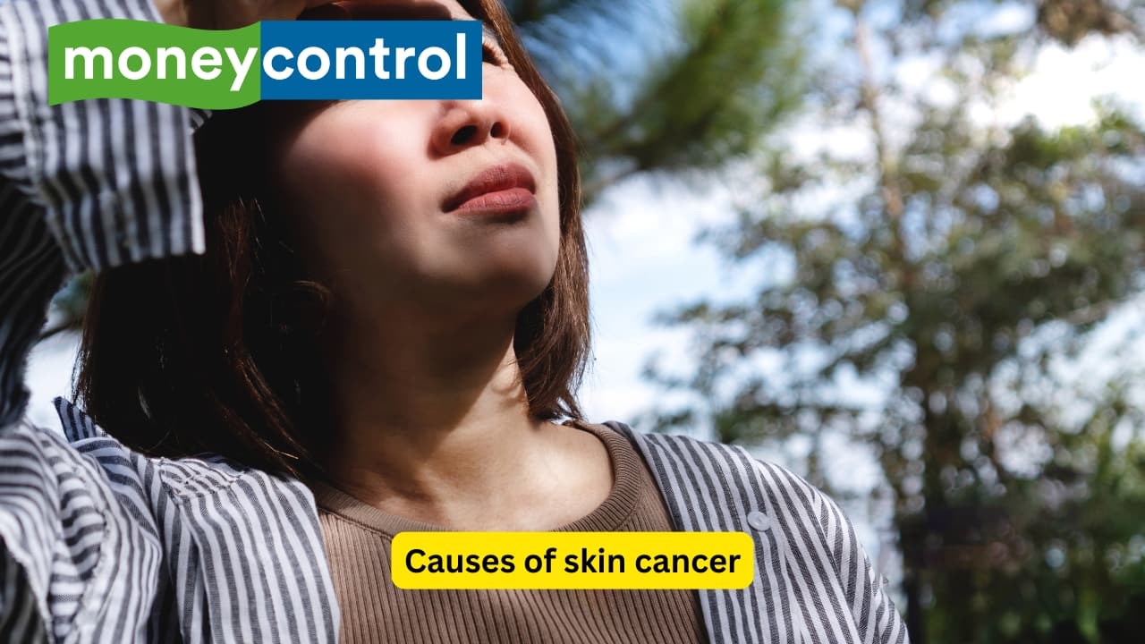 Causes of skin cancer UV radiation is the main cause of skin cancer. It passes through clouds, reflects off surfaces like sand and snow, and even penetrates glass. Repeated exposure—even mild sunburns—damages skin cells over time. However, daily sun protection can reduce your risk and save your skin. Know some simple habits to protect yourself from skin cancer(Image: Canva)