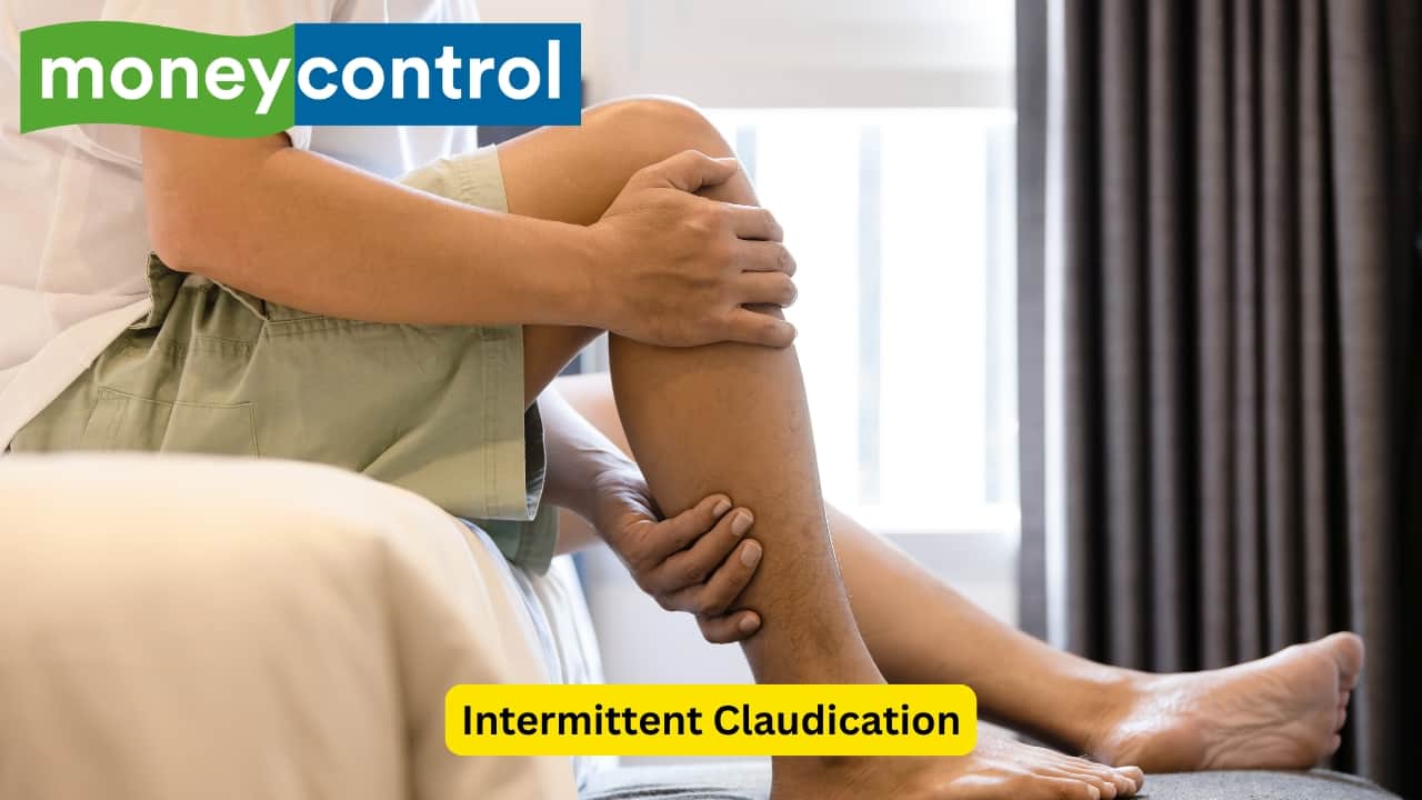 Intermittent Claudication One of the main symptoms of peripheral artery disease is intermittent claudication. Claudio means ‘I limp’ in Latin. It is a specific type of crampy pain that is often seen in the muscles of the limbs. The occlusion of arteries by atherosclerotic lesions is why this pain occurs.(Image: Canva)