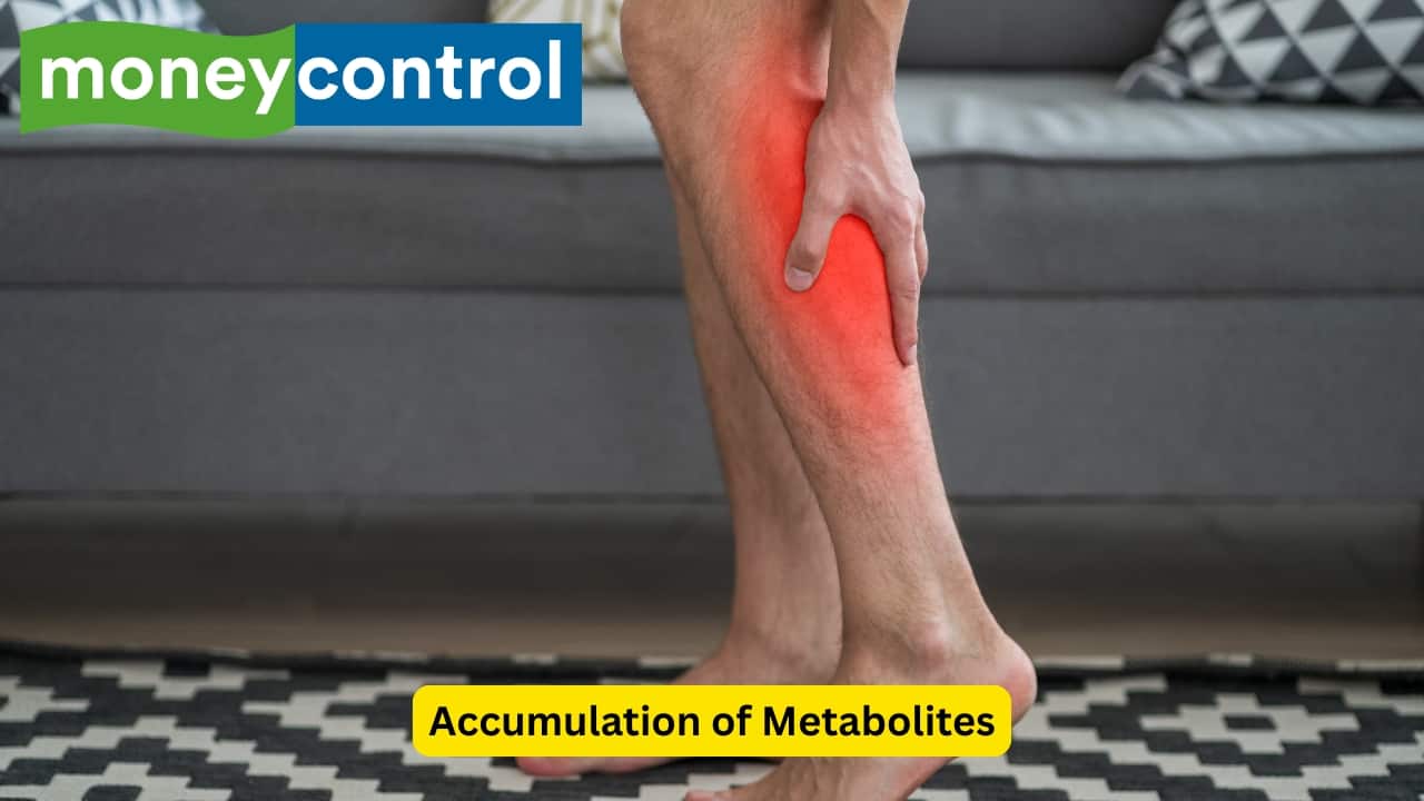 Accumulation of Metabolites Metabolites like lactic acid and substance P begin to accumulate in the muscles due to the blockage of the arteries, thus leading to intermittent claudication. One of the most common sites for this pain to occur is the calf. However, pain may also be seen in the foot and the thigh.(Image: Canva)