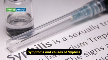 Causes of syphilis: Besides sexual contact, syphilis can spread through the placenta from the mother to the foetus, blood transfusion and direct contact with an open lesion (Image: Canva)