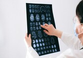 Fat buildup in the brain may weaken defenses in Alzheimer’s, not just plaques, say researchers