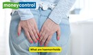 What are haemorrhoids? Understanding its causes, symptoms and treatment method