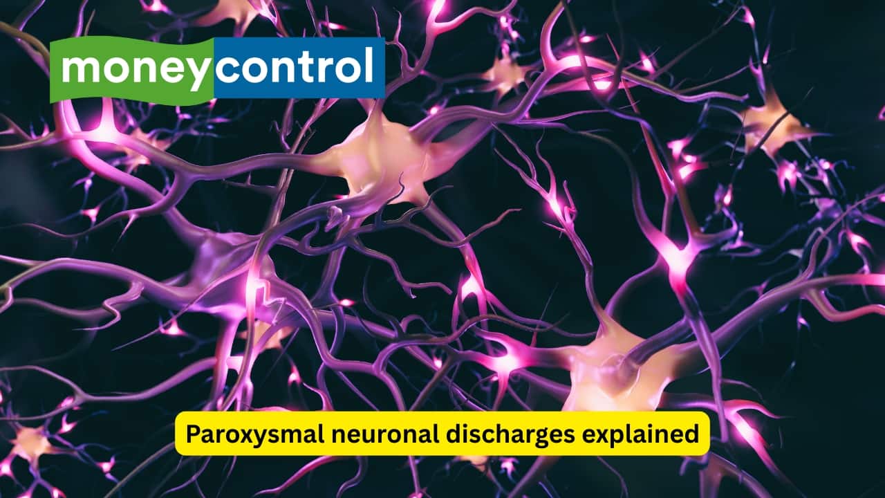 Paroxysmal neuronal discharges explained A seizure is a paroxysmal event that occurs because of abnormal and excessive discharges from the neurons of the central nervous system. When such seizures become recurrent due to some long-standing, underlying process, it is known as epilepsy. A person with correctable or avoidable seizures may not necessarily have epilepsy.(Image: Canva)