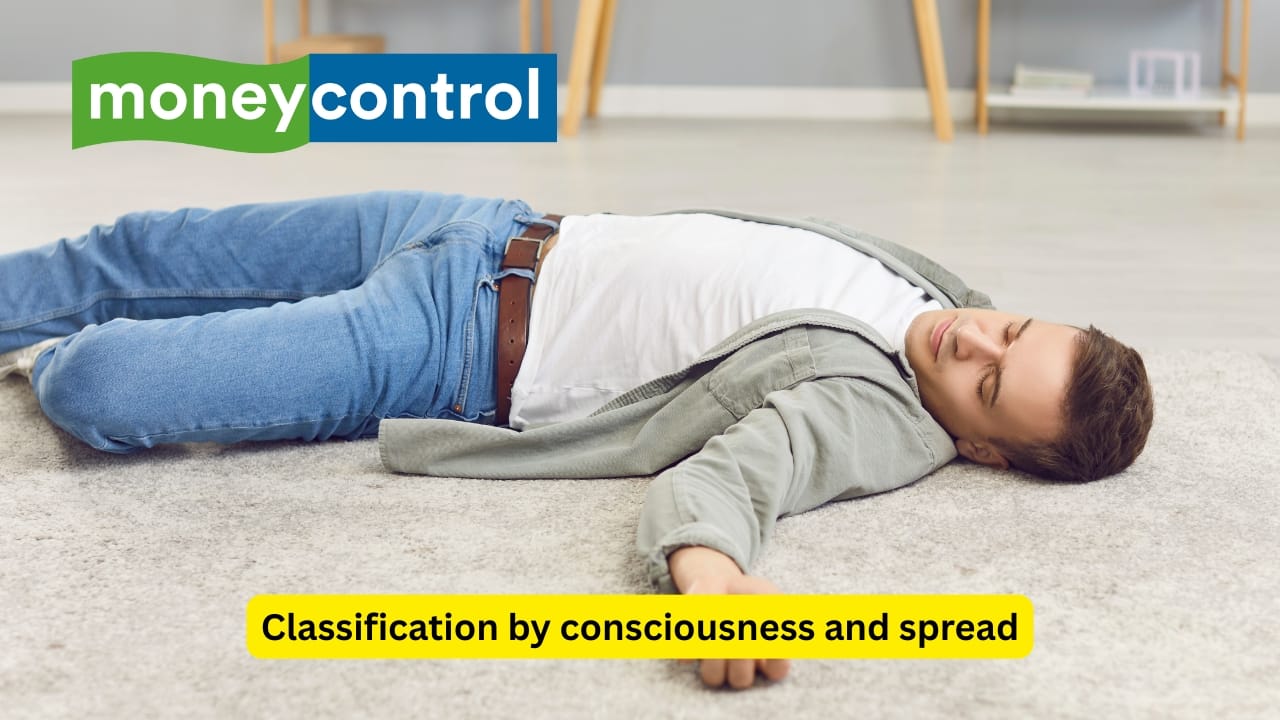 Classification by consciousness and spread Seizures are often classified as simple or complex depending upon the consciousness. If there is no alteration in consciousness, it is known as a simplex seizure, and if there is a history of loss of consciousness during the event, it is known as a complex seizure. They may also be either focal or generalised.(Image: Canva)