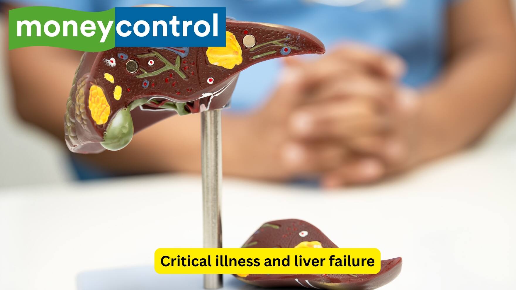 Critical illness and liver failure The presence of critical illnesses also influences the level of blood glucose. Hepatic failure may cause hypoglycemia, as the process of gluconeogenesis (production of glucose from non-carbohydrate substrates) and glycogenolysis are impaired. These processes are essential for maintaining the normal levels.(Image: Canva)