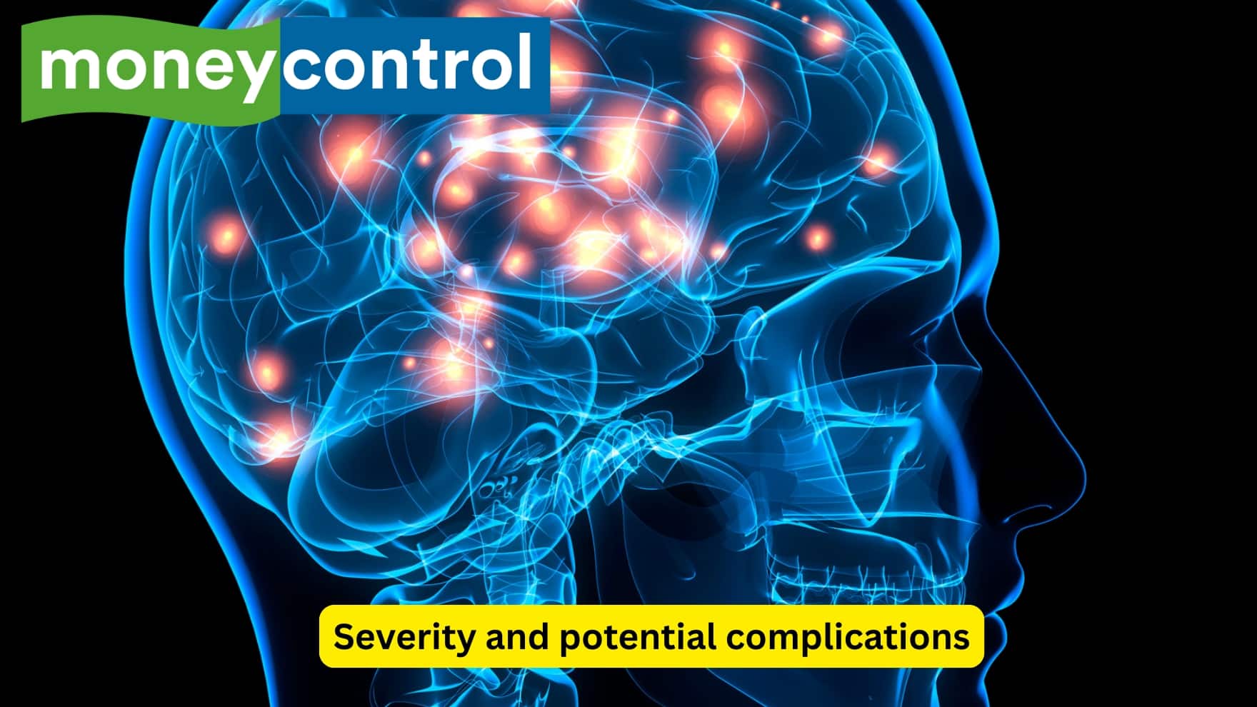 Severity and potential complications Hypoglycemia is a dangerous complication of oral hypoglycaemic drugs or insulin, and is considered to be more serious than hyperglycaemia, as long term reduction in blood glucose levels may potentially damage the brain in an irreversible way.(Image: Canva)