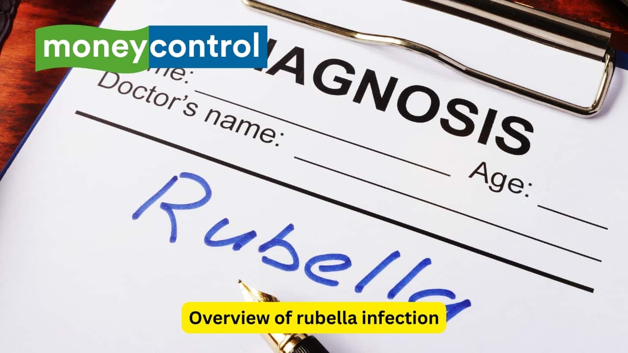 Overview of rubella infection Rubella, also known as German measles, is an infectious disease caused by a virus and is best identified by a rash. The RNA virus is transmitted through exposure to droplets of an infected person. Such an infection may attack a pregnant woman and can have dire complications if not identified and treated timely.(Image: Canva) Overview of rubella infection Rubella, also known as German measles, is an infectious disease caused by a virus and is best identified by a rash. The RNA virus is transmitted through exposure to droplets of an infected person. Such an infection may attack a pregnant woman and can have dire complications if not identified and treated timely.(Image: Canva)