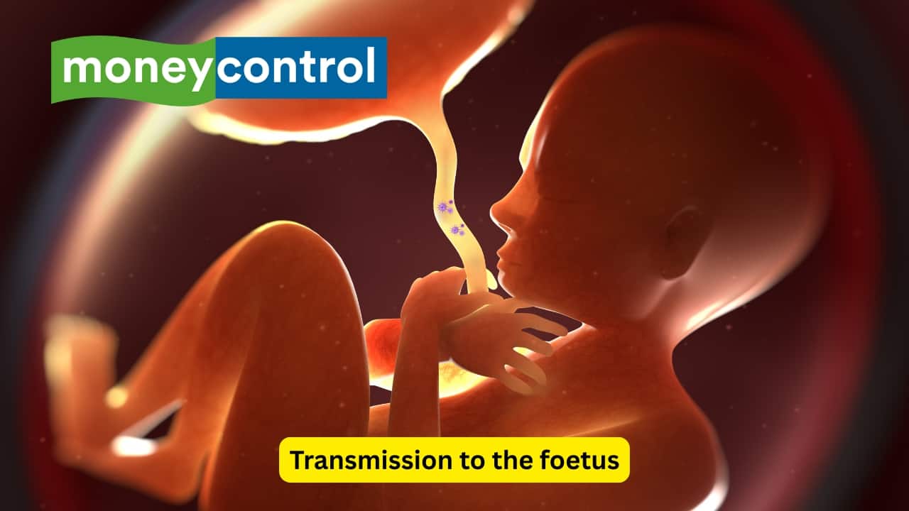  Transmission to the foetus The RNA virus causing Rubella may be transmitted from the mother to the foetus through the placenta. The highest risk of the foetus developing anomalies is during the first month, about 60%. It may also lead to congenital problems when the mother is infected during the second or the third month.(Image: Canva)