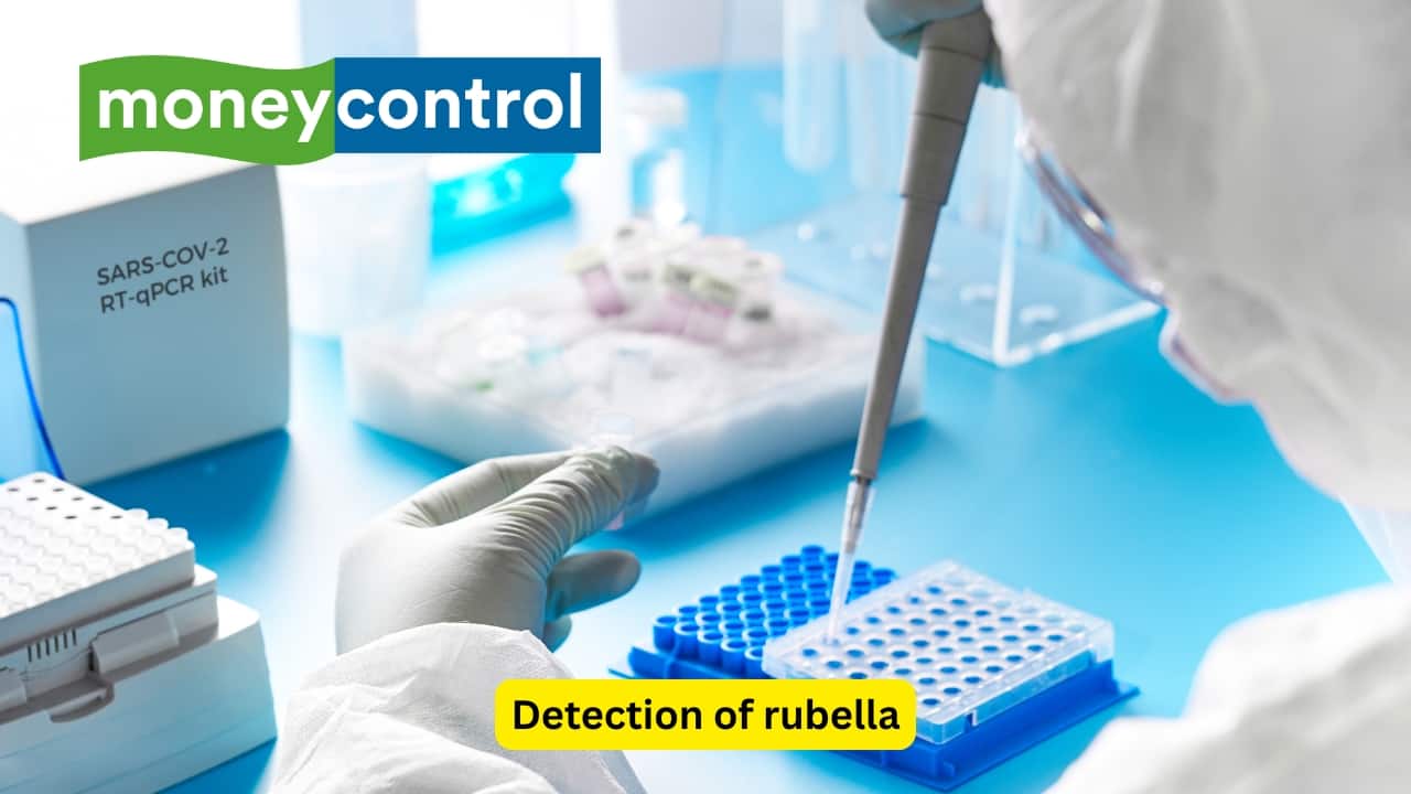 Detection of rubella In case the mother infected with Rubella is not vaccinated, the healthcare provider might consider therapeutic termination of pregnancy. A Polymerase Chain Reaction test may be recommended by the healthcare professional to detect the presence of the viral RNA that causes Rubella.(Image: Canva)
