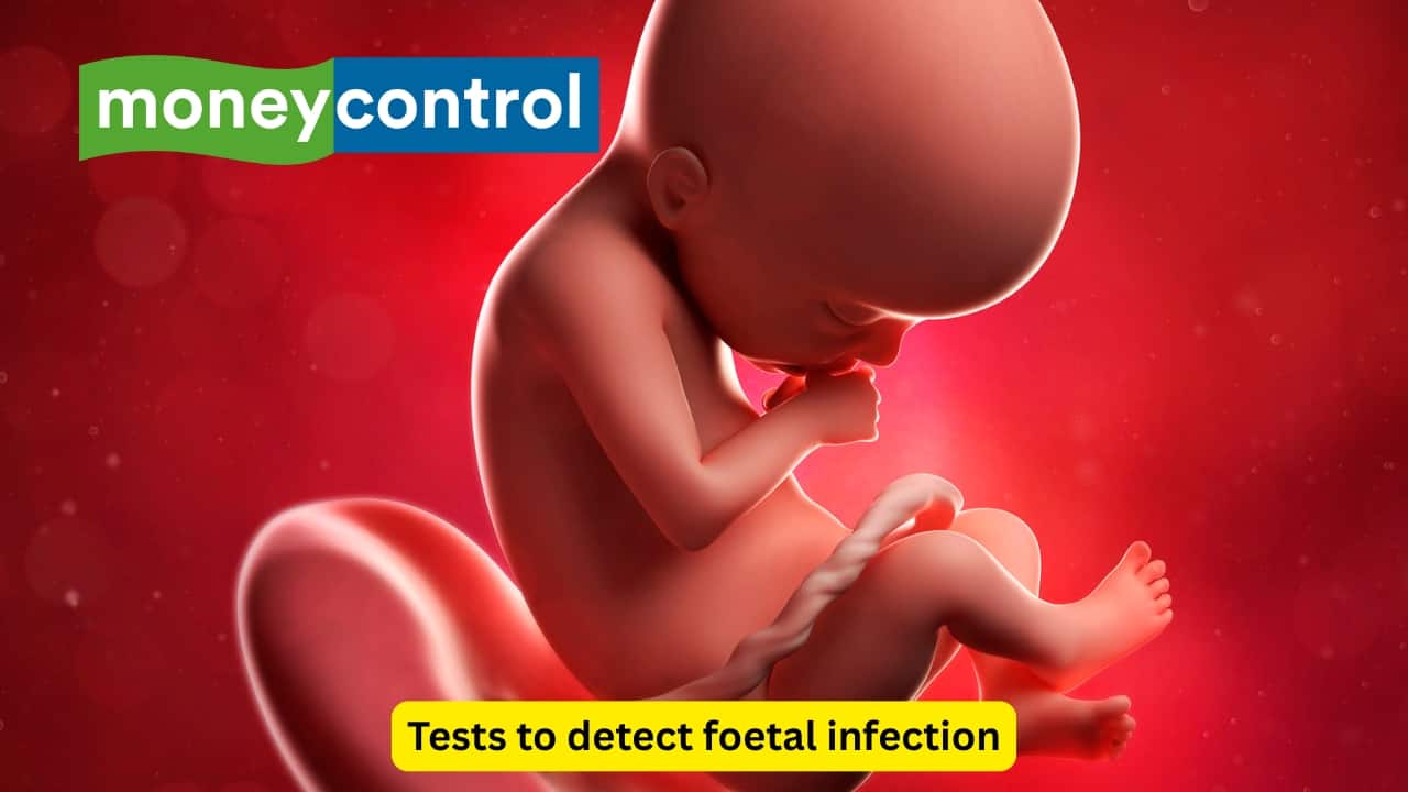 Tests to detect foetal infection To check whether the foetus has been infected with Rubella, a PCR may be done by using samples from the chorionic villi (finger-like projections that extend from the outer membrane of the foetus and form a part of the placenta), foetal blood and the amniotic fluid.(Image: Canva)