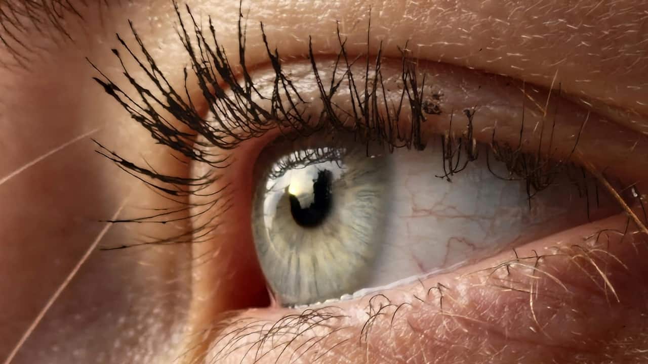 What causes eye floaters and how to treat them at home?