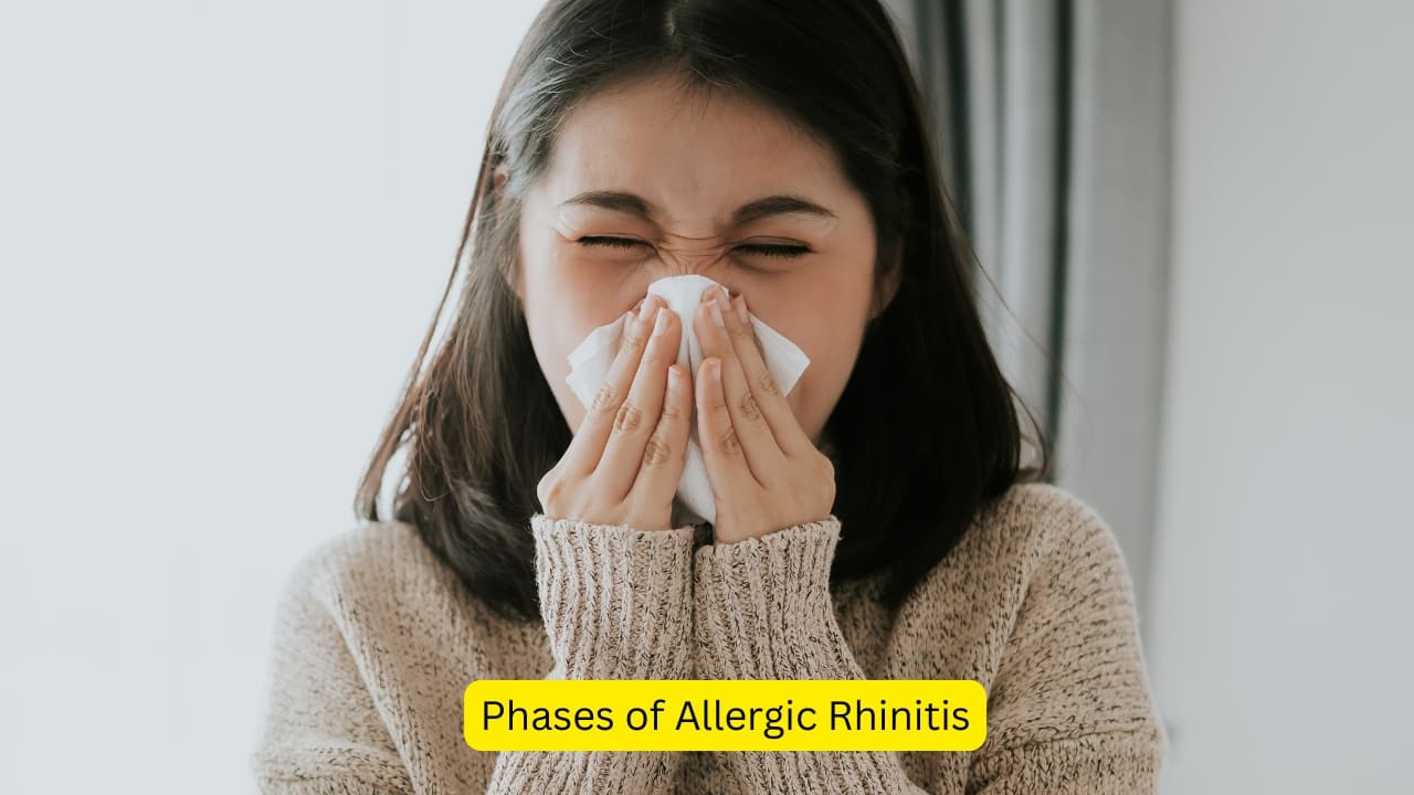 Phases of Allergic Rhinitis There are two phases of rhinitis, an acute or early phase and a late or delayed phase. In the acute phase, the allergic response occurs immediately, within half an hour, once the susceptible individual is exposed to a specific allergen in the environment. (Image: Canva)