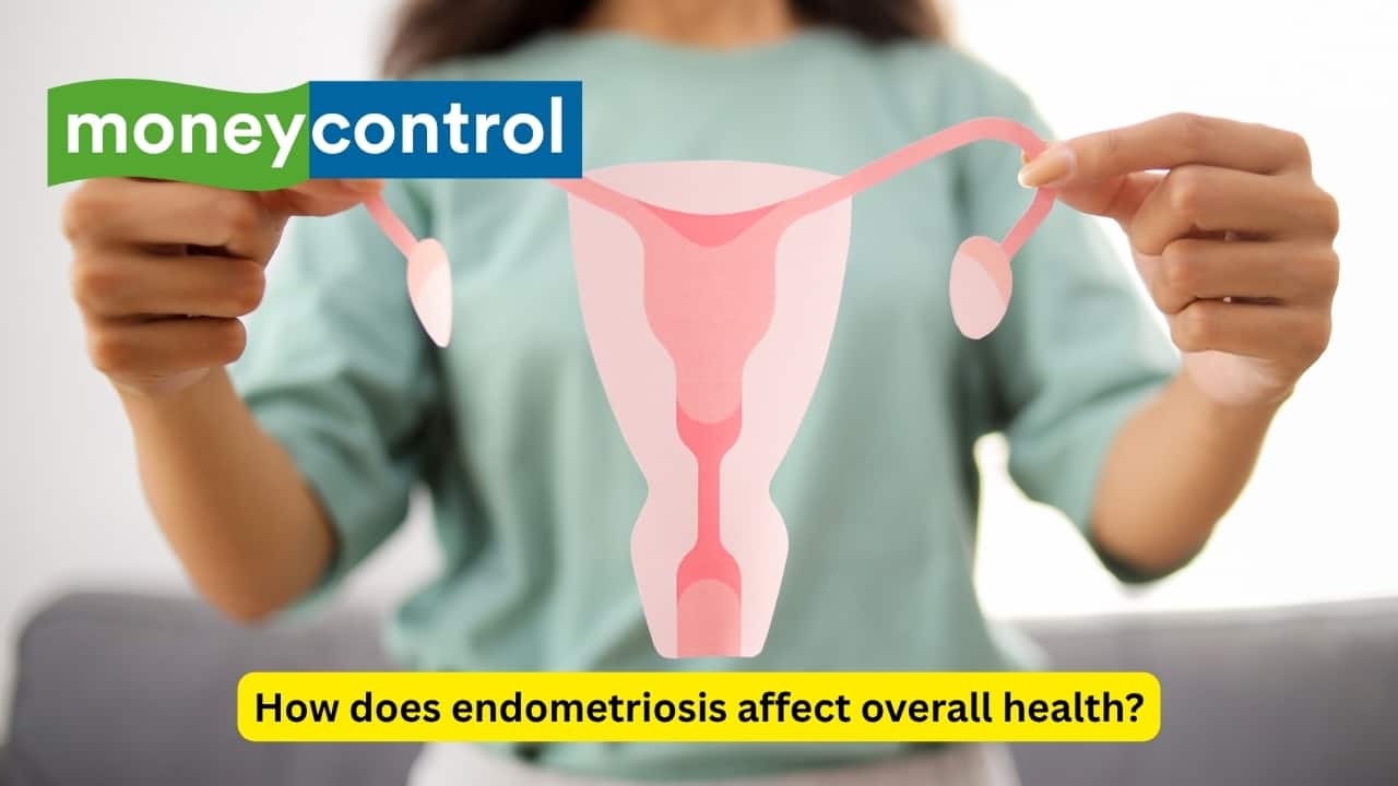 How does endometriosis affect overall health and what you can do to avoid it, according to a Gynaecologist