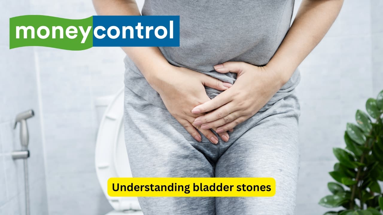 Understanding bladder stones: Causes, types, symptoms and management