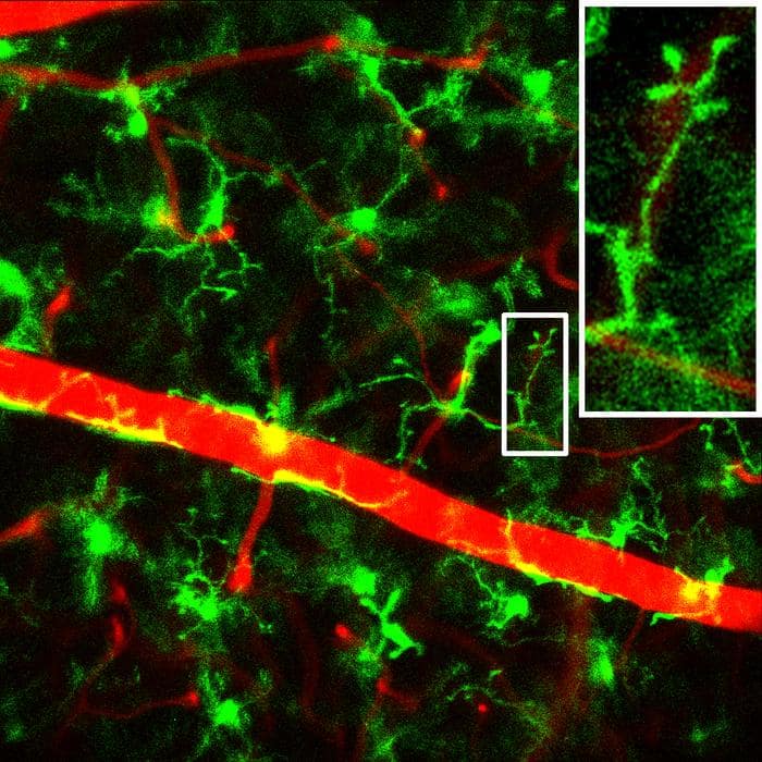 Live mouse retinal imaging could advance vision disease- Here is what research says