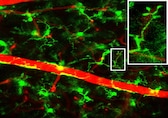 Live mouse retinal imaging could advance vision disease- Here is what research says