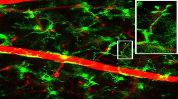 New imaging method tracks microglia movements in live mouse retina over time. (Image: TACHIBANA Yoshihisa/KUSUHARA Sentaro/SOTANI Noriyuki)