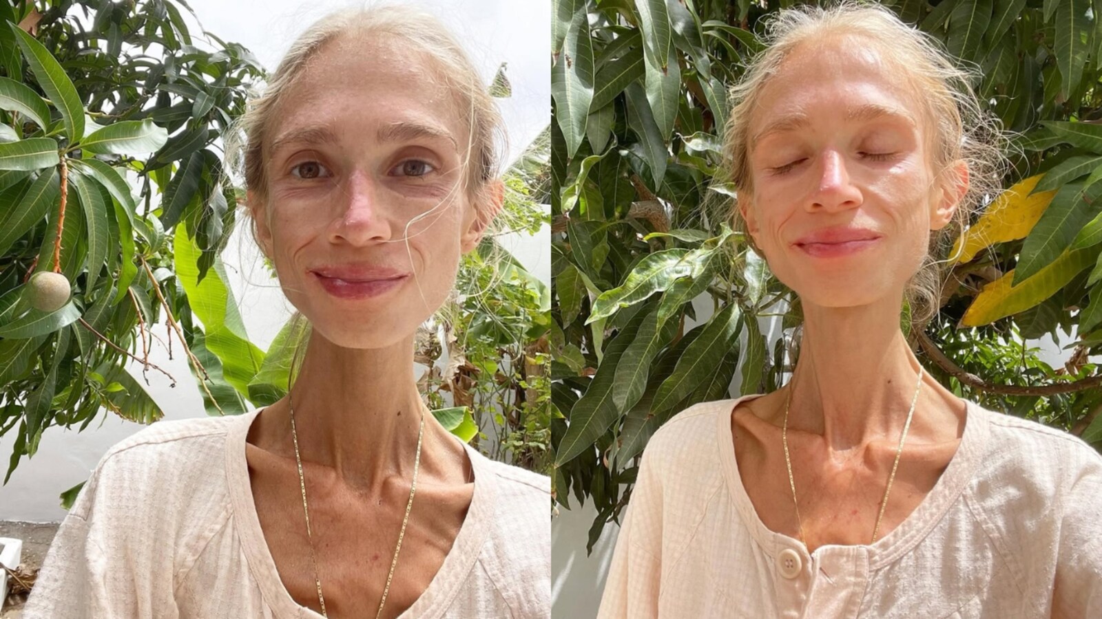 Woman, who weighed 23 kgs, on fruit diet dies of exhaustion; This is what  doctor has to say