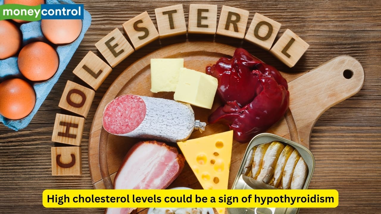 Did you know your high cholesterol levels could be a sign of hypothyroidism? Know symptoms and treatment Did you know your high cholesterol levels could be a sign of hypothyroidism? Know symptoms and treatment