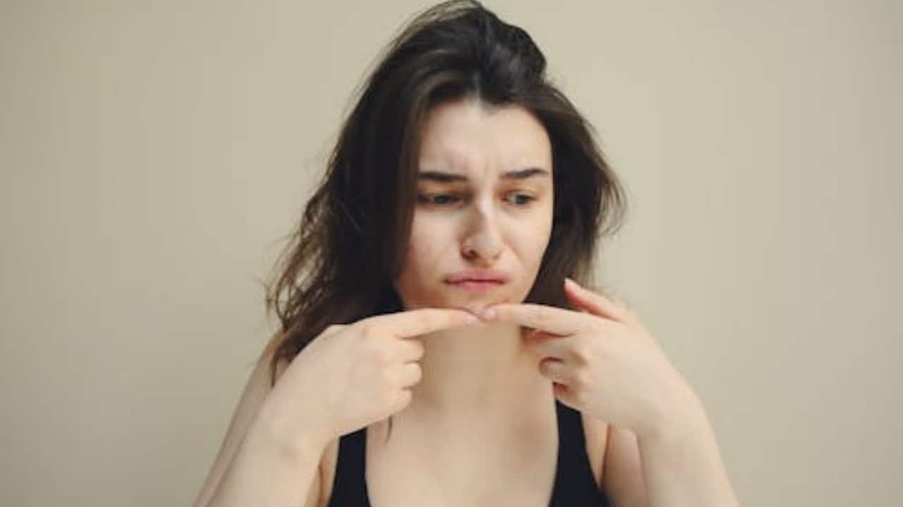 Understanding adult acne and what your skin is trying to tell you
