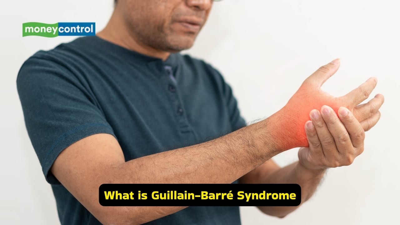 Guillain-Barré Syndrome causes, symptoms and treatment options (Image: Canva)